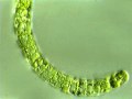 スピルリナ (Spirulina) 光学顕微鏡写真